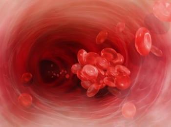 Family History, In Addition To Genetic and Environmental Risk Factors, Predicts Risk of Deep Vein Thrombosis