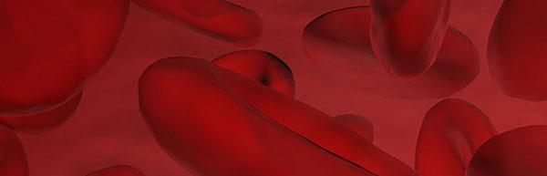 23andMe Updates Carrier Status Report on Sickle Cell Anemia
